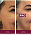 DermaLift PRO - Anti-Idade + Sérum com Trans-Resveratrol e Nanotecnologia - Imagem 5