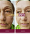 DermaLift PRO + Sérum com Trans-Resveratrol e Nanotecnologia | 4 Frascos + 2 Sérum - Imagem 3