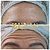 TOXINA BOTULÍNICA - Botox - Imagem 10