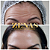 TOXINA BOTULÍNICA - Botox - Imagem 11