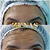 TOXINA BOTULÍNICA - Botox - Imagem 6