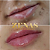 PREENCHIMENTO LABIAL - 1 ml de ácido hialurônico - Imagem 8
