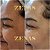 SKINBOOSTER - Imagem 3