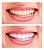 Whitemax Clareador Dental Carvão Ativado 100% Original - Kelly Key! - Imagem 2