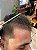 Redensyl Scolari 30ml - O Tônico Poderoso para Crescimento de Barba e Cabelo - Imagem 6