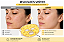 Máscara LED 4D Sunglor: Terapia de Rejuvenescimento Facial com 4 Comprimentos de Onda - Imagem 2