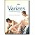 Livro Varizes: Conhecer para Prevenir - Imagem 1