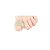 Anel Corretivo Com Almofada Para Joanete G 2 Em 1 Skingel Ortho Pahuer Sg326 [F083] - Imagem 2