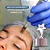 Smart Derma Pen - Caneta Elétrica de Microagulhamento - Imagem 4