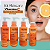 Skincare Anti-idade Kit Tratamento Facial 4 Itens - Rhenuks - Imagem 2