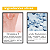 Kit Skincare Anti-acne Rhenuks Completo 4 Itens - Imagem 4