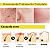 Kit Skincare Anti-acne Rhenuks Completo 4 Itens - Imagem 8