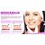 Microcânulas Para Preenchimento Facial + agulha de pertuito 25G x 50mm (10 unidades) - Imagem 5