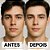 LABOTRAT Kit Antiacne - Sabonete , Tônico e Gel  - Reduz Espinhas e Oleosidade com Efeito Antimarcas - Imagem 8