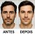 LABOTRAT Kit Facial Retinol - Redução de Rugas e Linhas de Expressão - Imagem 5