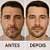 LABOTRAT Kit Facial Retinol - Redução de Rugas e Linhas de Expressão - Imagem 6
