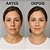LABOTRAT Kit Facial Retinol - Redução de Rugas e Linhas de Expressão - Imagem 8