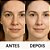 LABOTRAT Kit Facial Retinol - Redução de Rugas e Linhas de Expressão - Imagem 9