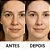 LABOTRAT Kit Facial Retinol - Redução de Rugas e Linhas de Expressão - Imagem 10