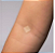 Curativo Adesivo Redondo Stopper Slim Hipoalergênico Bege 500 Uni – Blood Stop - Imagem 4