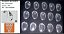 Plaqueta Encaixe D-Shape - Imagem 2