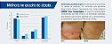 Ectopure Creme Hidratação Prolongada 7% 30ML - PROMOÇÃO - APROVEITE!!! - Imagem 3