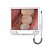 Câmera Intraoral com Monitor de 17 polegadas - Biotron - Imagem 1