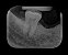 Raio-X Intraoral Pantográfico DC X-Mind Parede Alta Frequência - Acteon - Imagem 8