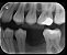 Raio-X Intraoral Pantográfico DC X-Mind Parede Alta Frequência - Acteon - Imagem 7