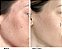 Dr. Dennis Gross Skincare Alpha Beta® Universal Daily Peel - Imagem 2