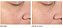 Dr. Dennis Gross Skincare Alpha Beta® Pore Perfecting & Refining Serum - Imagem 2