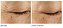 Dr. Dennis Gross Skincare Ferulic + Retinol Triple Correction Eye Serum - Imagem 2