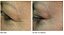 Dr. Dennis Gross Skincare DRx SpectraLite™ EyeCare Pro - Imagem 3