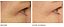 Dr. Dennis Gross Skincare DRx SpectraLite™ EyeCare Pro - Imagem 2