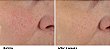 Dr. Dennis Gross Skincare Advanced Retinol + Ferulic Overnight Texture Renewal Peel - Imagem 2