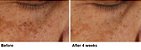 Dr. Dennis Gross Skincare Advanced Retinol + Ferulic Overnight Texture Renewal Peel - Imagem 3