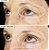 StriVectin Peptight ™ 360˚ Tightening Eye Serum - Imagem 2