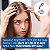 Neutrogena Scalp Therapy™ Anti-Dandruff Daily Control - Imagem 4