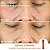 Dr. Dennis Gross Skincare Firm + Bright + Glow Vitamin C Lactic Set - Edição Limitada - Imagem 6