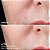 BeautyBio Get That Glow - GloPRO® Facial Microneedling Discovery Set - Imagem 3