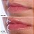BeautyBio The Pout Sparkling Rosé Hyaluronic Acid Collagen Plumping Lip Serum - Imagem 5