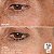 BeautyBio Eye Want It All Face + Eye Microneedling Set - Imagem 3