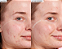 Glow Recipe Blackberry Retinol Blemish Serum - Imagem 2
