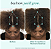 Nutrafol WOMEN’S BALANCE 45+ Clinically Proven Hair Growth Supplement for Thinning - Imagem 2