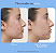 Nutrafol Clear Skin Physician-formulated Acne & Post-acne Dark Spot Supplement for Women - Imagem 3
