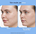 Nutrafol Clear Skin Physician-formulated Acne & Post-acne Dark Spot Supplement for Women - Imagem 4