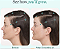 Nutrafol WOMEN Clinically Proven Hair Growth Supplement for Thinning - Imagem 3