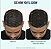Nutrafol MEN Clinically Proven Hair Growth Supplement for Thinning - Imagem 2