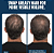 Nutrafol Men's Active Cleanse Scalp Shampoo + Conditioner for Thinning Hair - Imagem 3