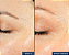 Summer Fridays  Jet Lag Overnight Eye Serum for Fine Lines & Wrinkles with Gentle Retinol Blend - Imagem 2